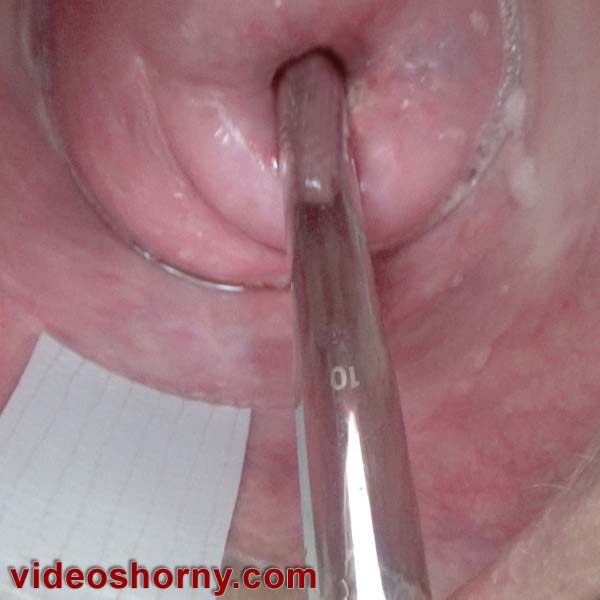 Cervix masturbation with a german sound of 10 mm diameter