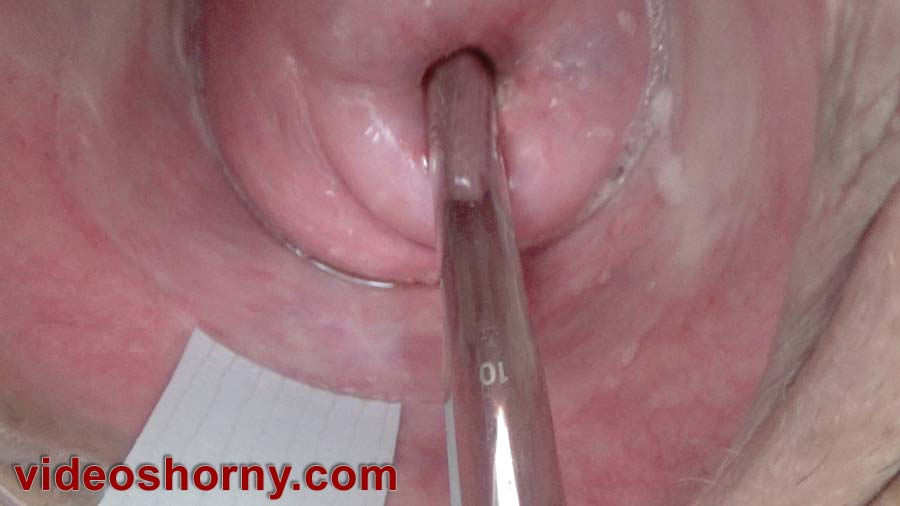 Fucking cervix with a huge german sound of 10 mm