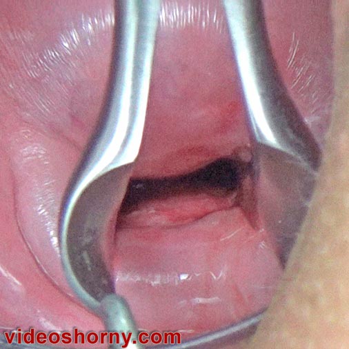 Col de l’utérus ouvert avec spéculum pour l’imprégnation avec injection de sperme