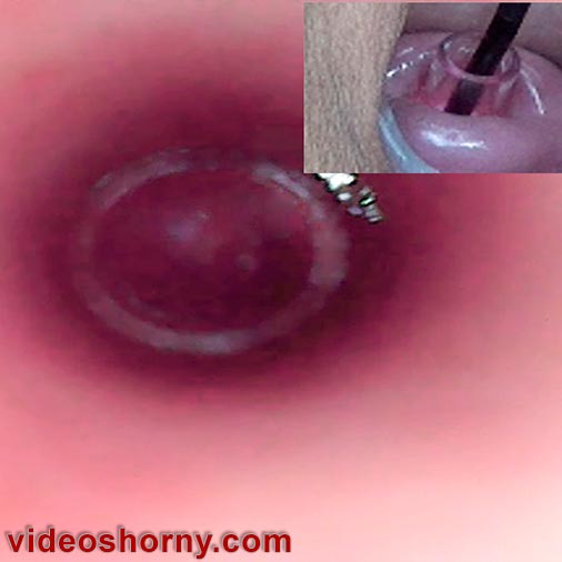 子宮内に日本の内視鏡カメラで子宮頸部の内部を見る